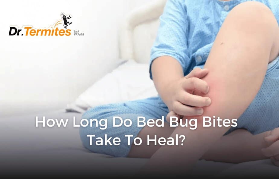 How Long Do Bed Bug Bites Take To Heal Dr Termites 
